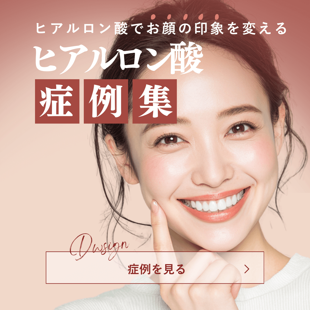 ヒアルロン酸症例集
