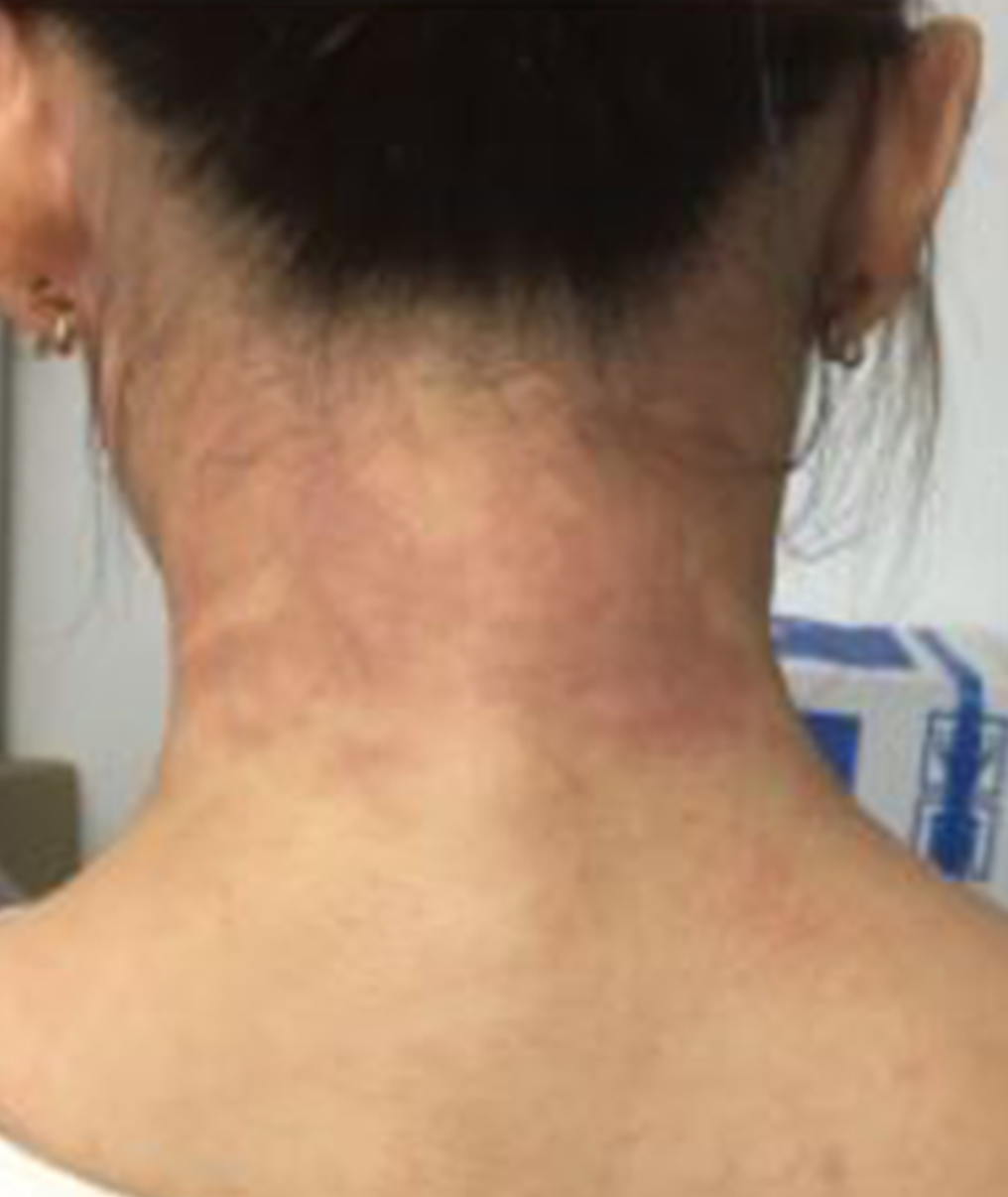 Unstress アンストレス