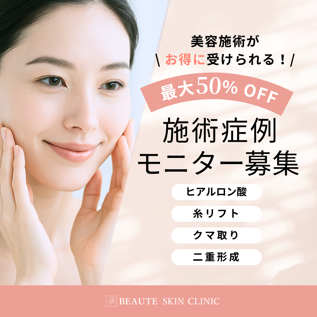 モニター募集