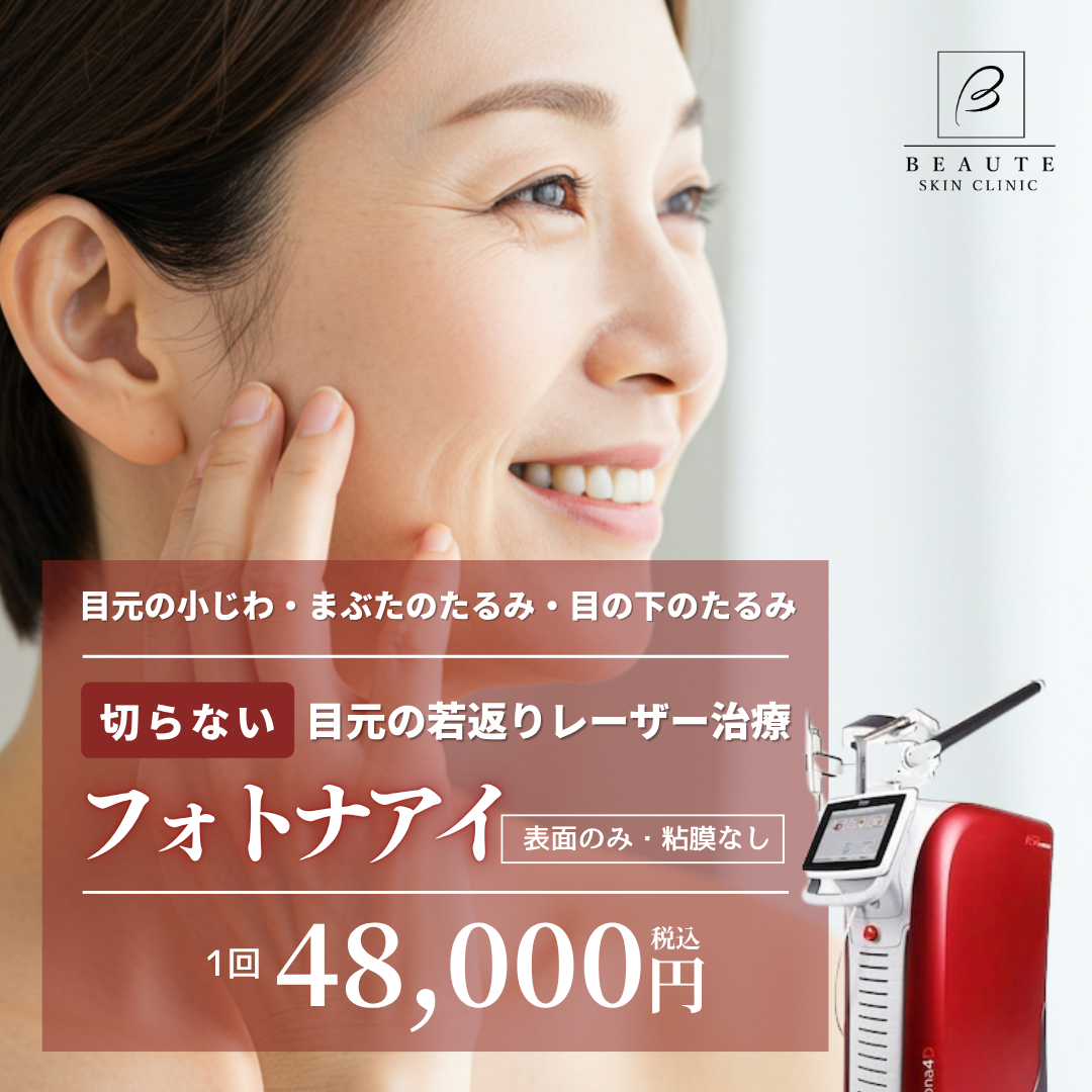 フォトナアイ