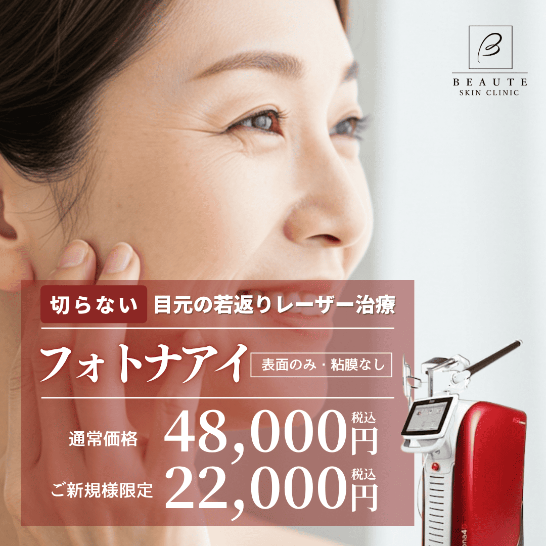 フォトナアイ