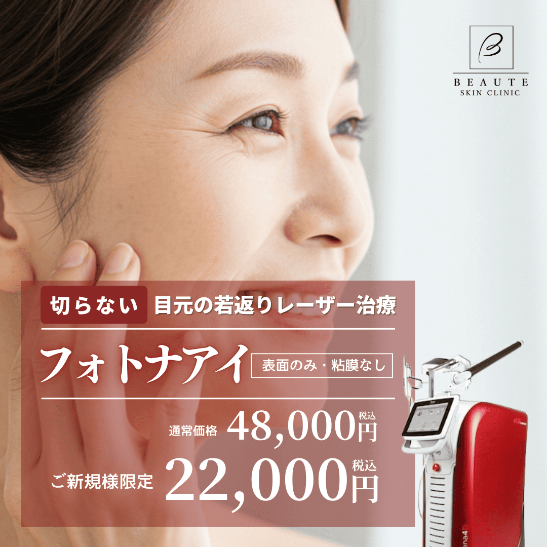 フォトナアイ