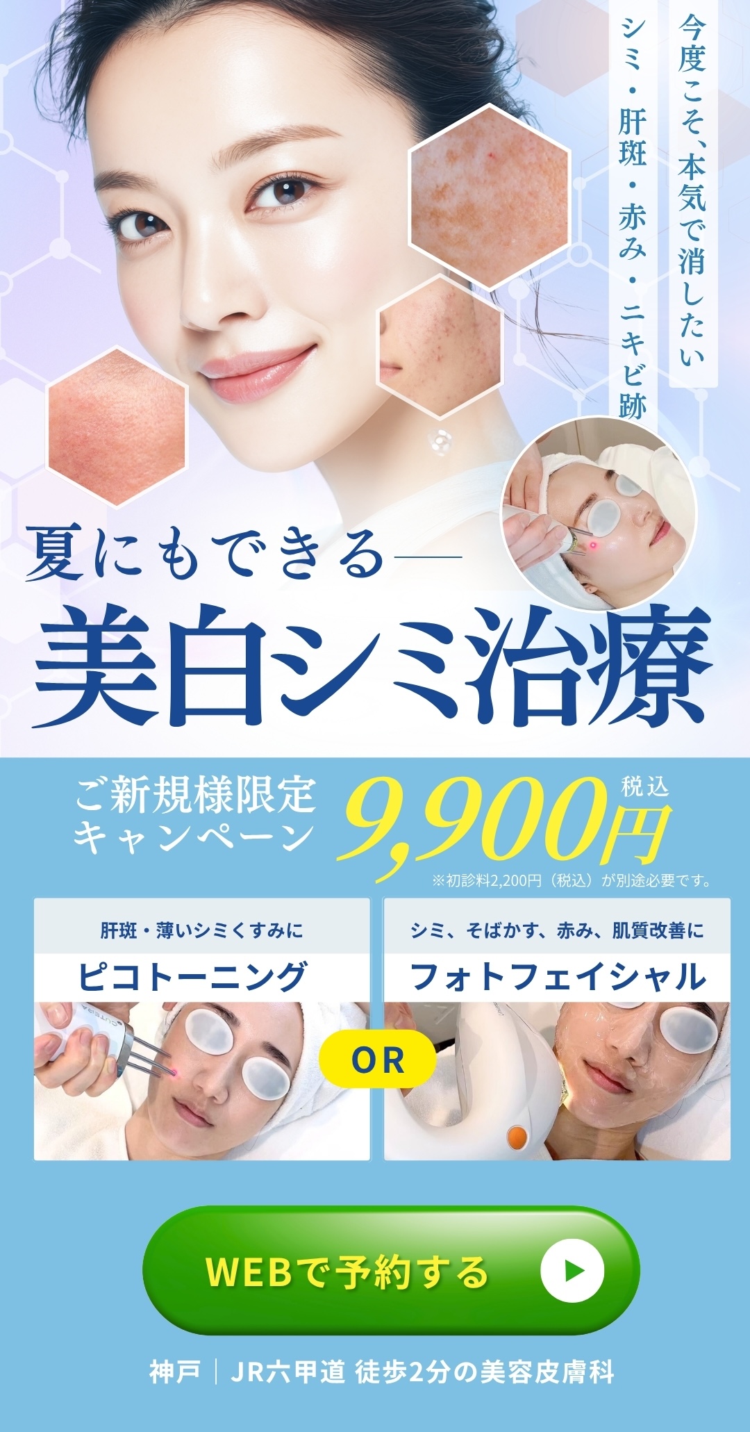 夏にもできる美白シミ治療 ピコトーニング・フォトフェイシャル ご新規様限定9,900円（税込）／初診料2,200円別途