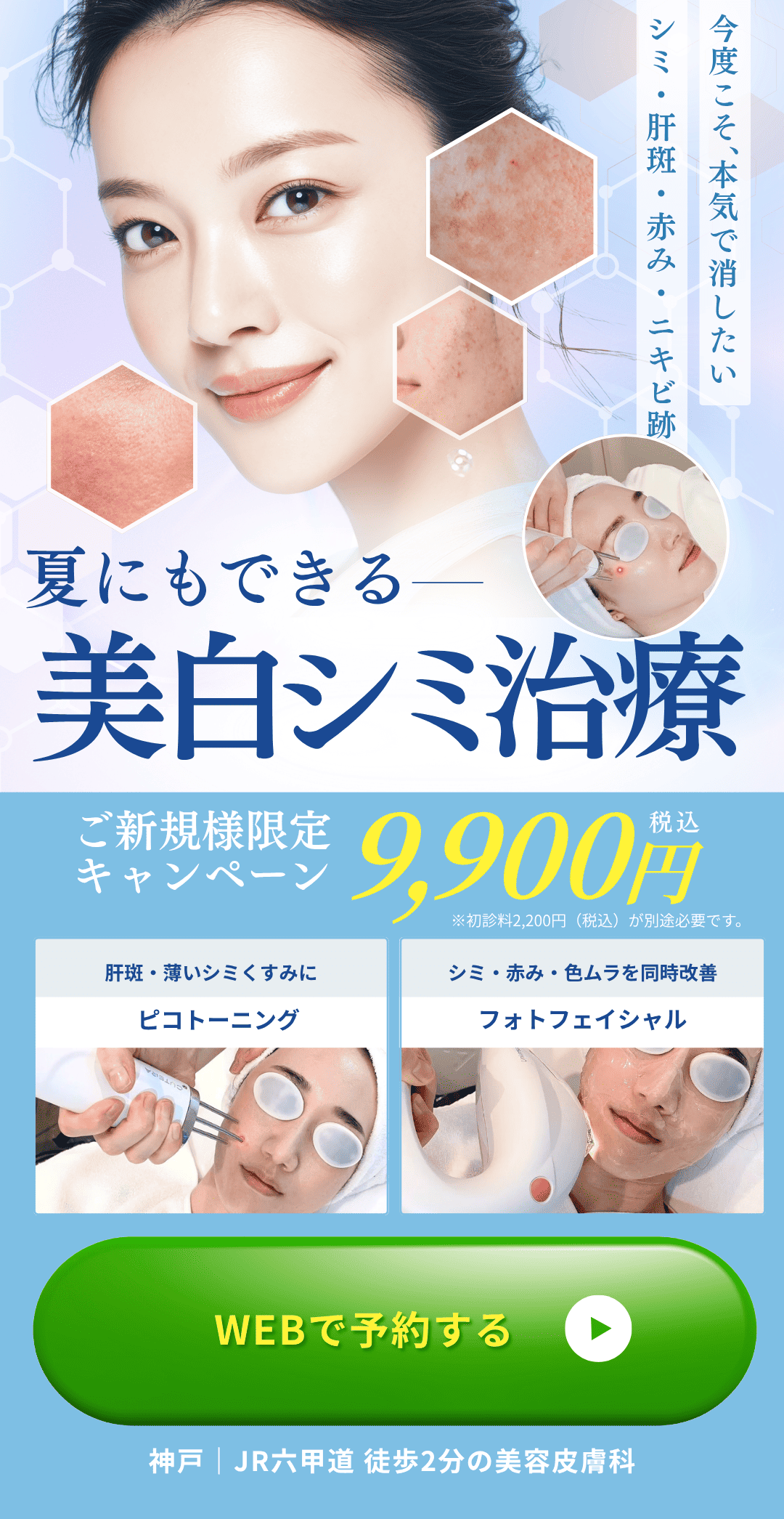 夏にもできる美白シミ治療 ピコトーニング・フォトフェイシャル ご新規様限定9,900円（税込）／初診料2,200円別途