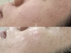 赤み・敏感のお悩みイメージ