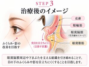 STEP3 治療後のイメージの模式図